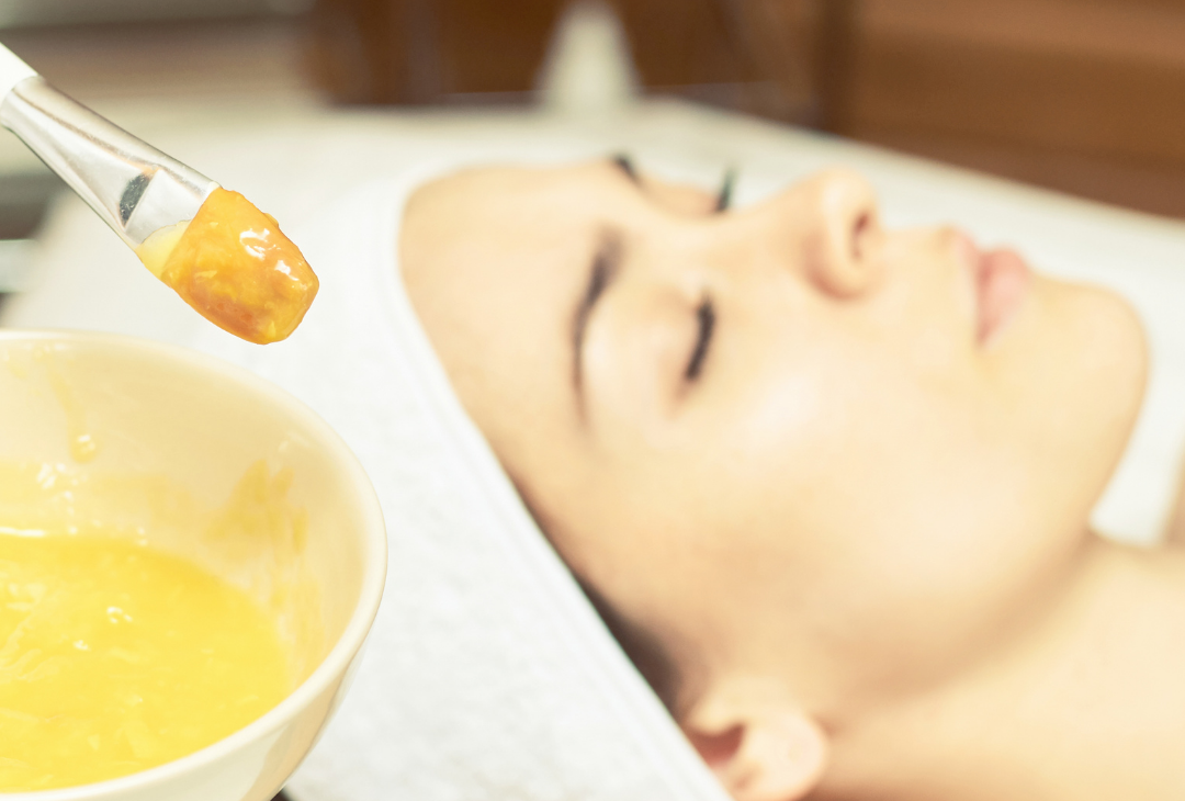 chemical peel treatment